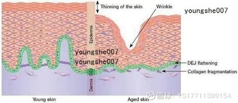 乙酰基十肽-3 增加肌肤弹性 减少细纹